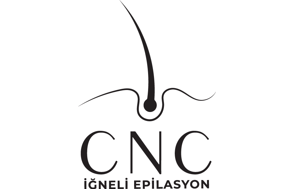 cnc lazer iğneli epilasyon