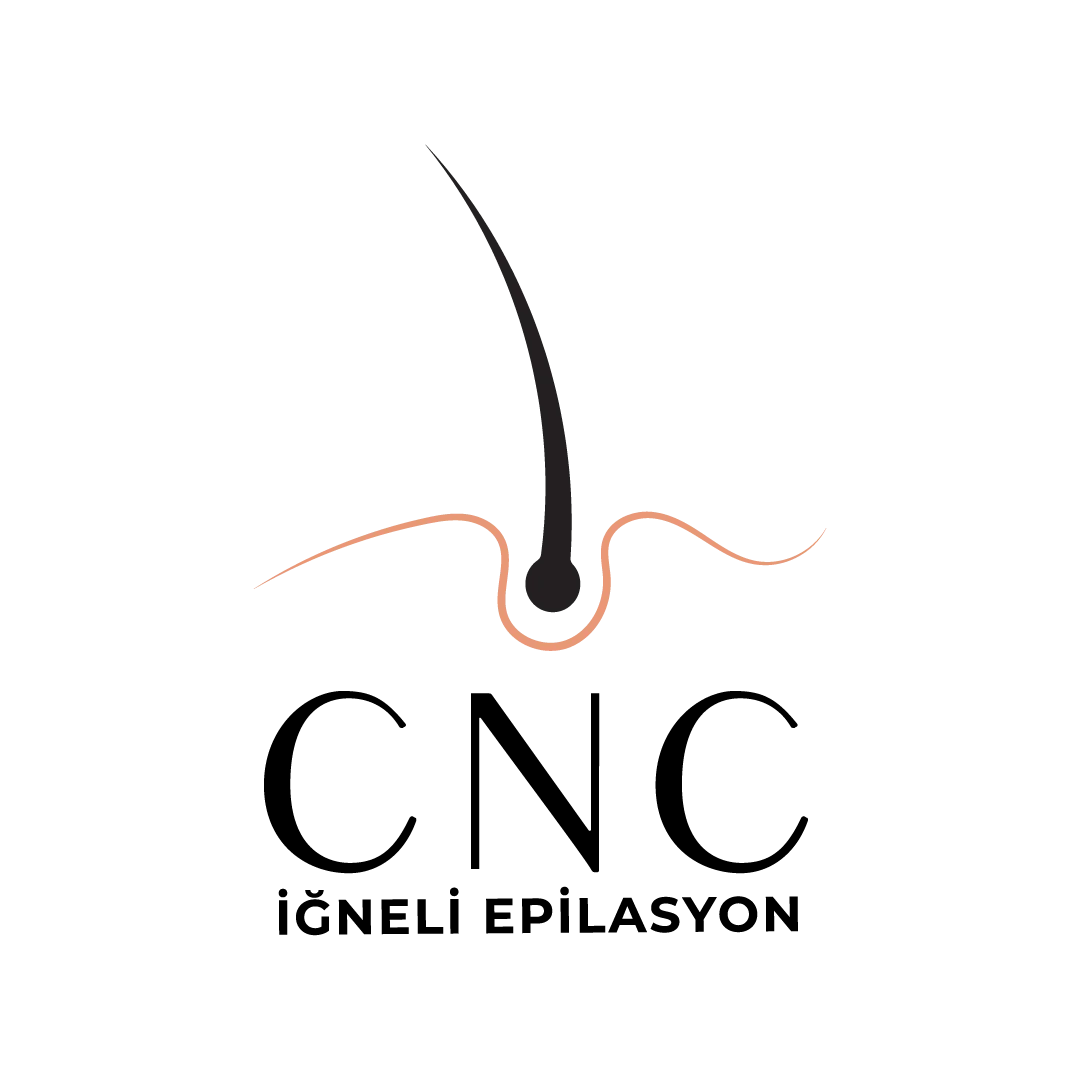 cnc-igneli-epilasyon